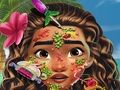Игра Моана доктор за кожа онлајн Игра Моана доктор за кожа онлајн
