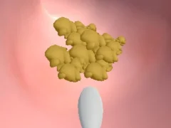 Игра Earwax Clinic онлајн