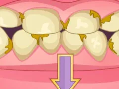 Игра Bad Teeth Makeover онлајн