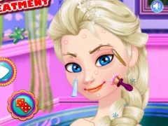 Игра Ice Queen Acne Treatment онлајн
