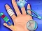 Игра Hand Treatment онлајн