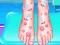 Игра Emma Foot Treatment онлајн