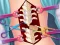 Игра Anna Scoliosis Surgery онлајн