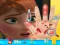 Игра Anna hand doctor онлајн