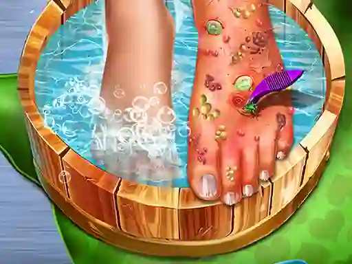 Игра Feet Skin Doctor онлајн
