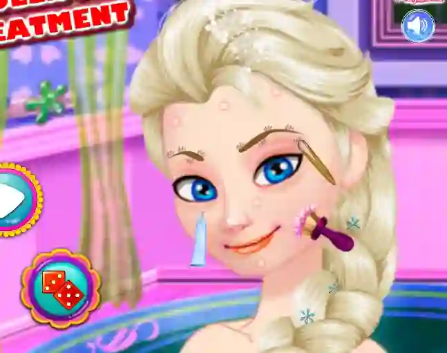 Игра Ice Queen Acne Treatment онлајн
