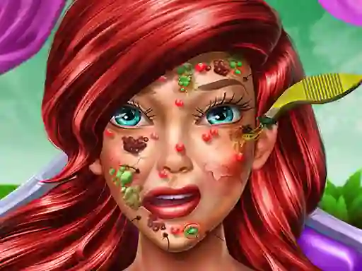 Игра Princess Mermaid Skin Doctor онлајн