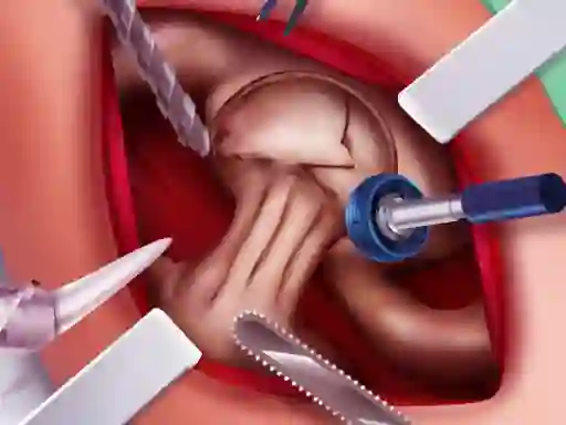 Игра Princess Hips Surgery онлајн